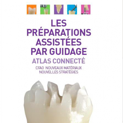 Les préparations assistées par guidage - Atlas connecté